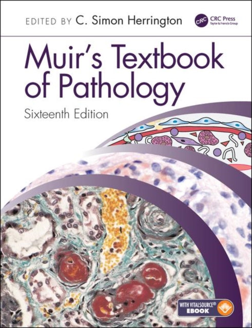 Book cover of: Muir's Textbook of Pathology. By: C. Simon Herrington