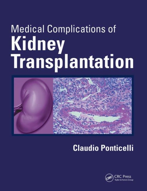 Book cover of: Medical Complications of Kidney Transplantation. By: Claudio Ponticelli