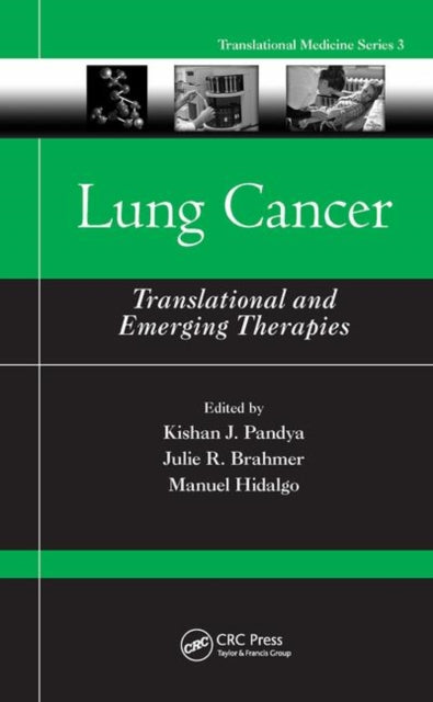 Book cover of: Lung Cancer