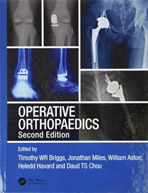 Book cover of: Operative Orthopaedics. By: Timothy Briggs