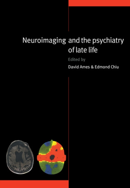 Book cover of: Neuroimaging and the Psychiatry of Late Life. By: David Ames