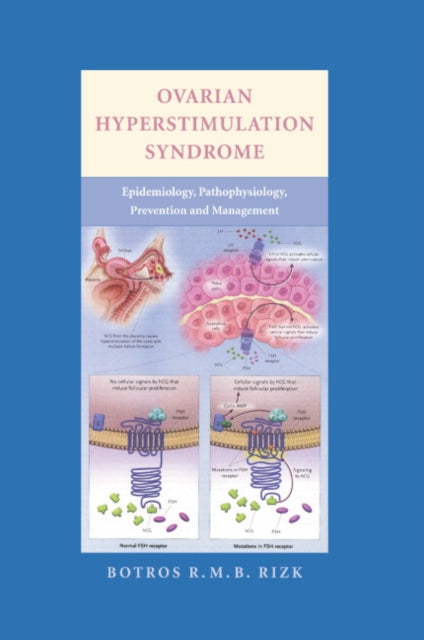 Book cover of: Ovarian Hyperstimulation Syndrome. By: Botros Rizk