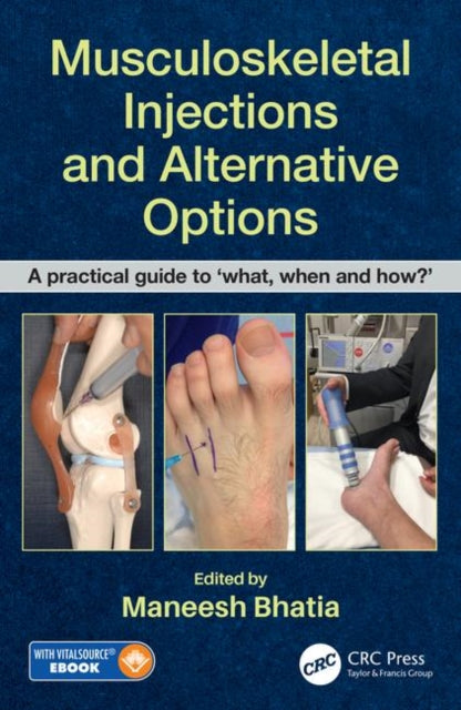 Book cover of: Musculoskeletal Injections and Alternative Options