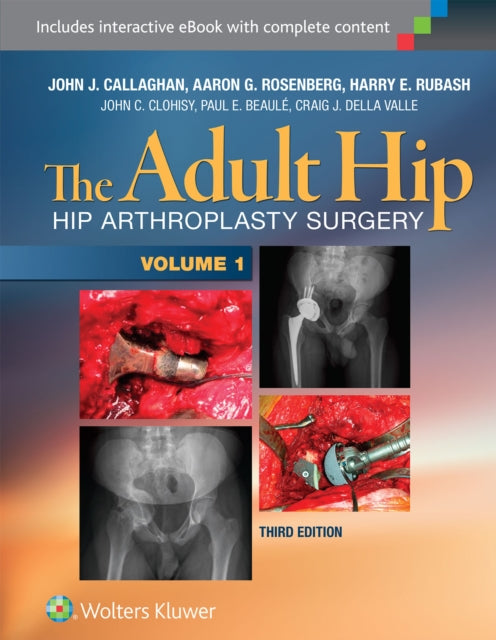 Book cover of: Adult Hip (Two Volume Set). By: John J. Callaghan