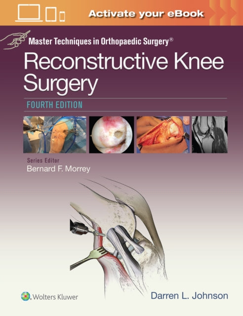 Book cover of: Master Techniques in Orthopaedic Surgery: Reconstructive Knee Surgery. By: Darren L. Johnson MD