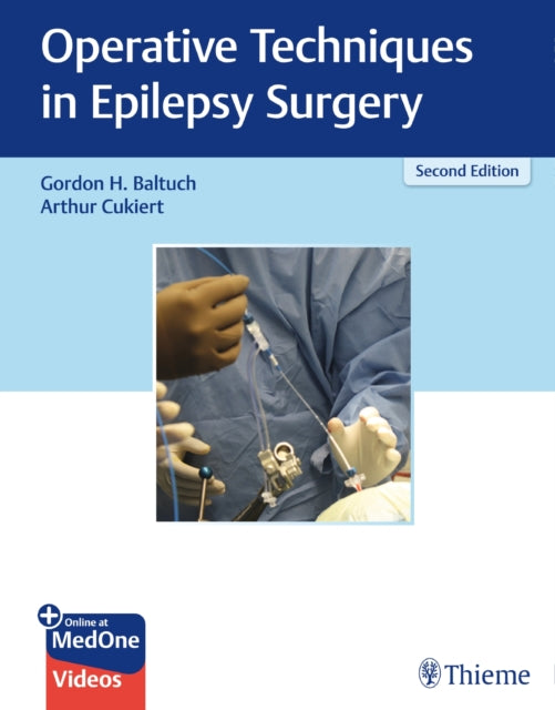 Book cover of: Operative Techniques in Epilepsy Surgery. By: Gordon H. Baltuch