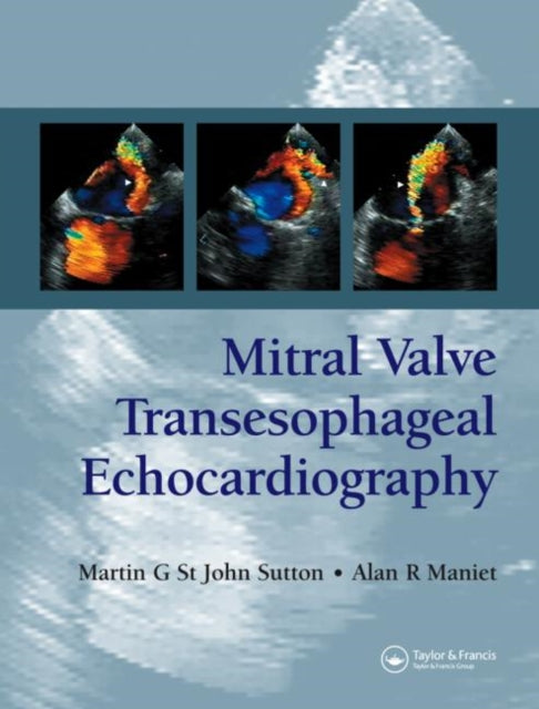 Book cover of: Mitral Valve Transesophageal Echocardiography. By: Martin G. St. John Sutton