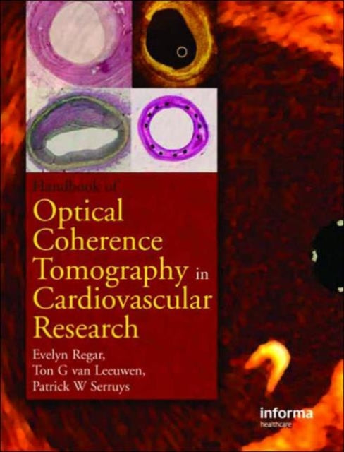 Book cover of: Optical Coherence Tomography in Cardiovascular Research