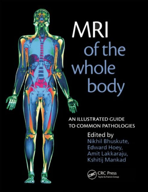 Book cover of: MRI of the Whole Body. By: Kshitij Mankad