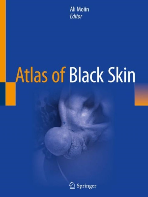 Book cover of: Atlas of Black Skin. By: Ali Moiin