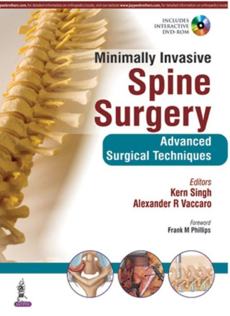 Book cover of: Minimally Invasive Spine Surgery. By: Kern Singh