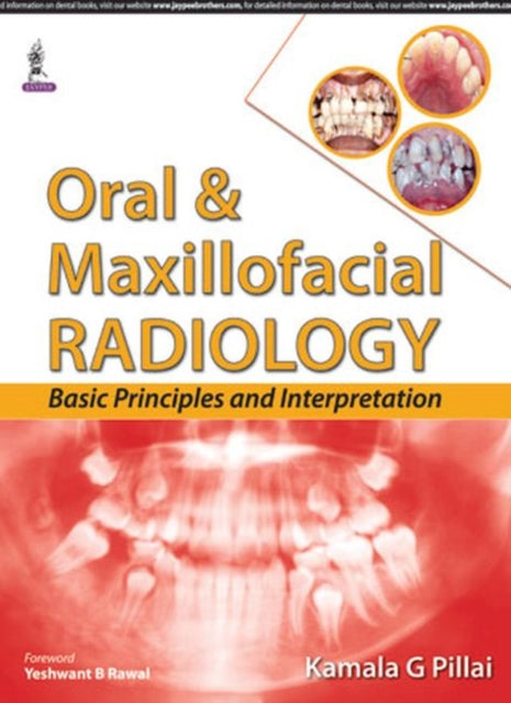 Book cover of: Oral & Maxillofacial Radiology. By: Kamala G. Pillai