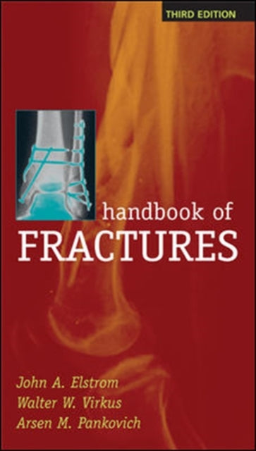 Book cover of: Handbook of Fractures, Third Edition. By: John A. Elstrom