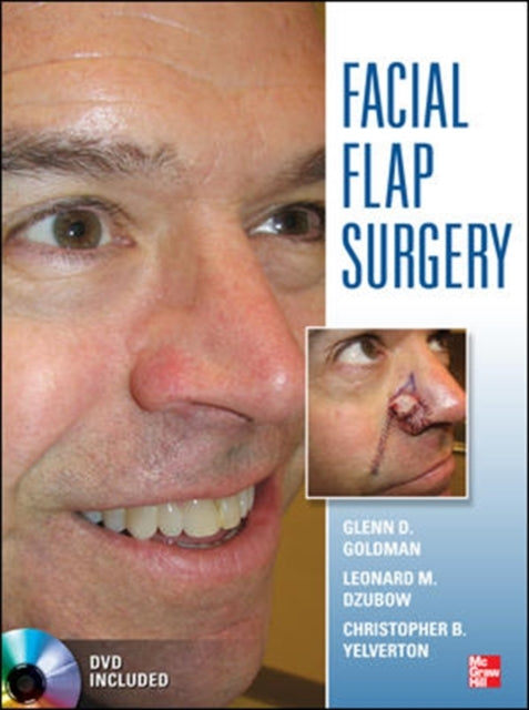 Book cover of: Facial Flaps Surgery. By: Glenn Goldman