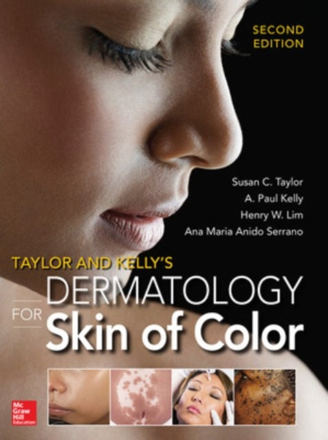 Book cover of: Taylor and Kelly's Dermatology for Skin of Color 2/E. By: Susan Taylor