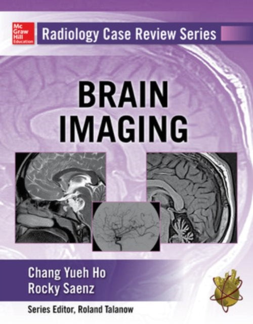 Book cover of: Radiology Case Review Series: Brain Imaging. By: Chang Ho