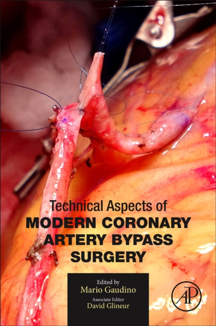 Book cover of: Technical Aspects of Modern Coronary Artery Bypass Surgery. By: Mario Gaudino