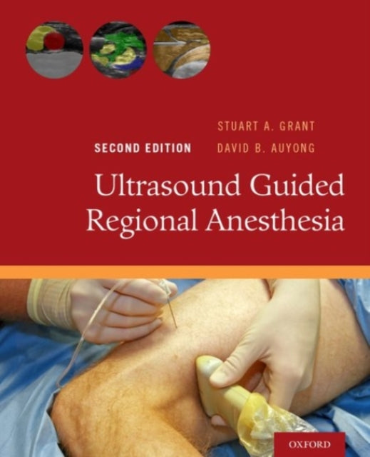 Book cover of: Ultrasound Guided Regional Anesthesia. By: Stuart A. Grant