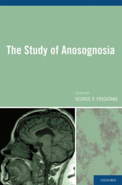 Book cover of: Study of Anosognosia. By: George P. Prigatano