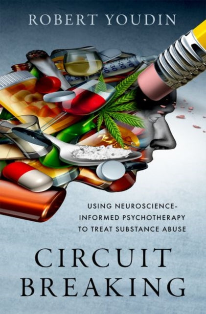 Book cover of: Circuit Breaking. By: Robert Youdin