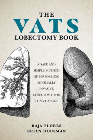 VATS Lobectomy Book