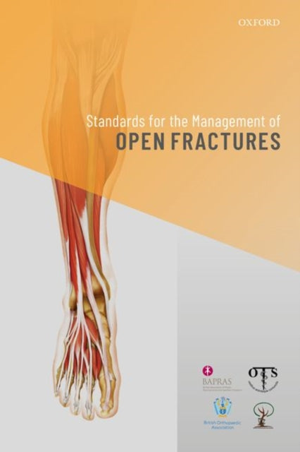 Book cover of: Standards for the Management of Open Fractures. By: Simon Eccles