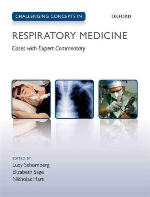 Book cover of: Challenging Concepts in Respiratory Medicine. By: Lucy Schomberg