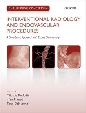 Challenging Concepts in Interventional Radiology