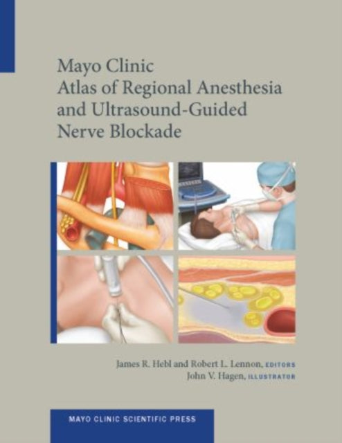 Book cover of: Mayo Clinic Atlas of Regional Anesthesia and Ultrasound-Guided Nerve Blockade. By: James R. Hebl