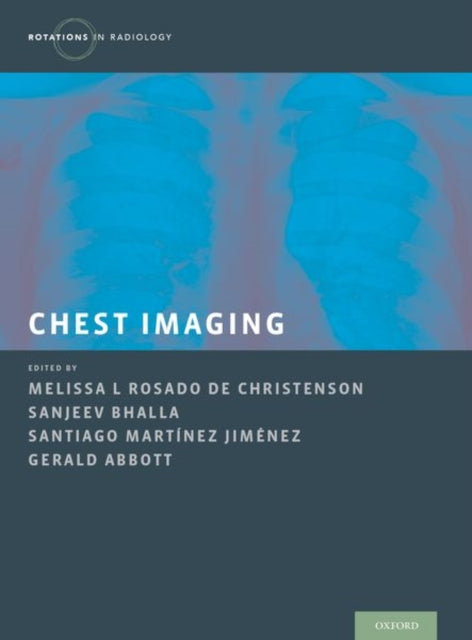 Book cover of: Chest Imaging. By: Melissa Rosado de Christenson