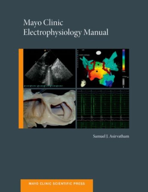 Book cover of: Mayo Clinic Electrophysiology Manual. By: Samuel J. Asirvatham