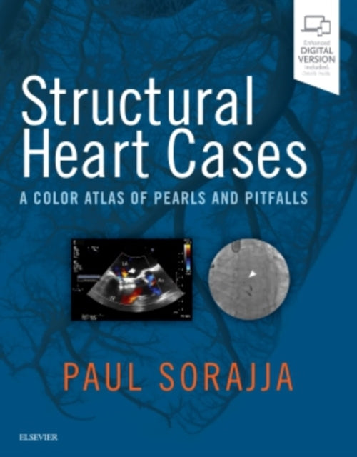 Book cover of: Structural Heart Cases. By: Paul Sorajja