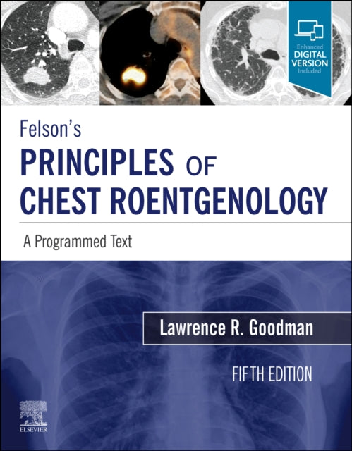 Book cover of: Felson's Principles of Chest Roentgenology, A Programmed Text. By: Lawrence R. Goodman