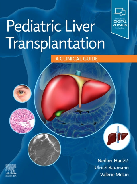 Book cover of: Pediatric Liver Transplantation. By: Nedim Hadzic