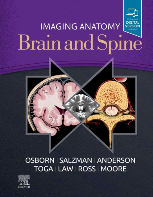 Book cover of: Imaging Anatomy Brain and Spine. By: Anne G. Osborn