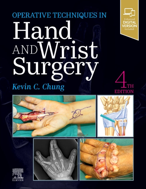 Book cover of: Operative Techniques: Hand and Wrist Surgery. By: Kevin C. Chung MD  MS