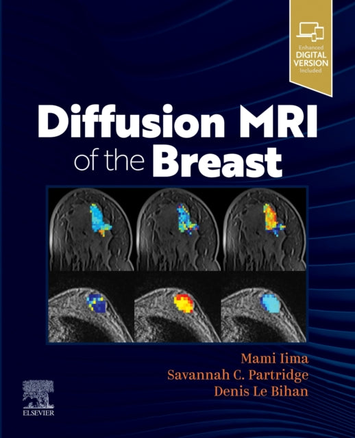 Book cover of: Diffusion MRI of the Breast. By: Mami Iima