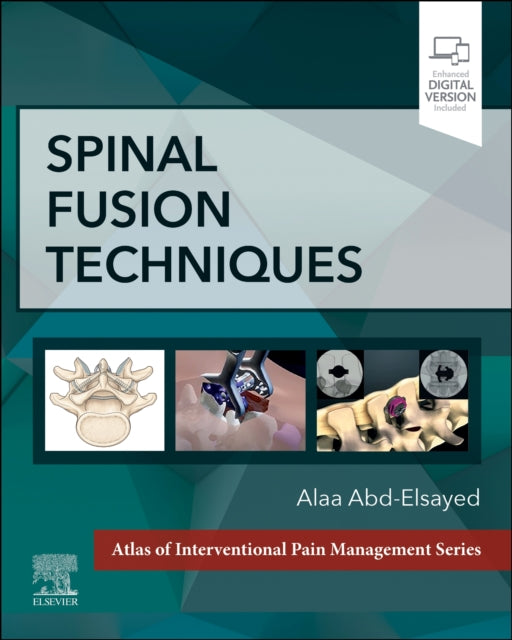 Book cover of: Spinal Fusion Techniques. By: Alaa Abd-Elsayed
