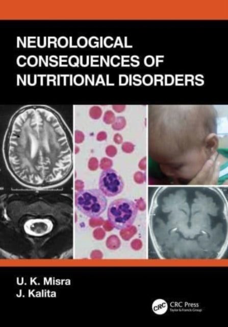 Book cover of: Neurological Consequences of Nutritional Disorders. By: U. K. Misra