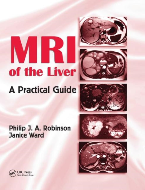 Book cover of: MRI of the Liver. By: Philip J. A. Robinson