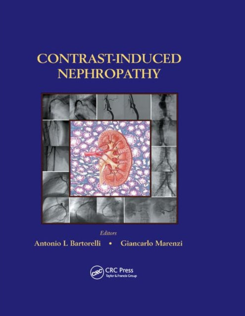 Book cover of: Contrast-Induced Nephropathy in Interventional Cardiovascular Medicine. By: Antonio L. Bartorelli