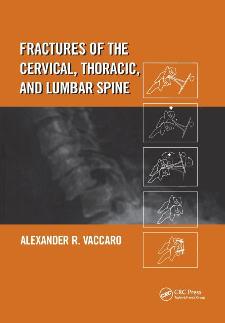Book cover of: Fractures of the Cervical, Thoracic, and Lumbar Spine. By: Alexander R. Vaccaro