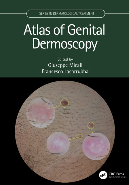 Book cover of: Atlas of Genital Dermoscopy. By: Giuseppe Micali