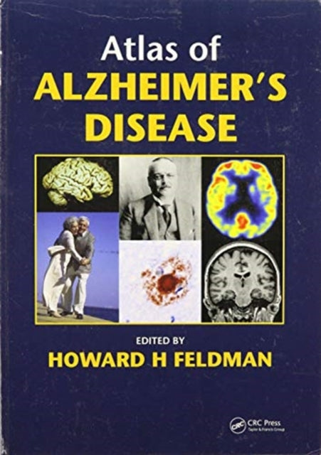 Book cover of: Atlas of Alzheimer's Disease. By: Howard Feldman