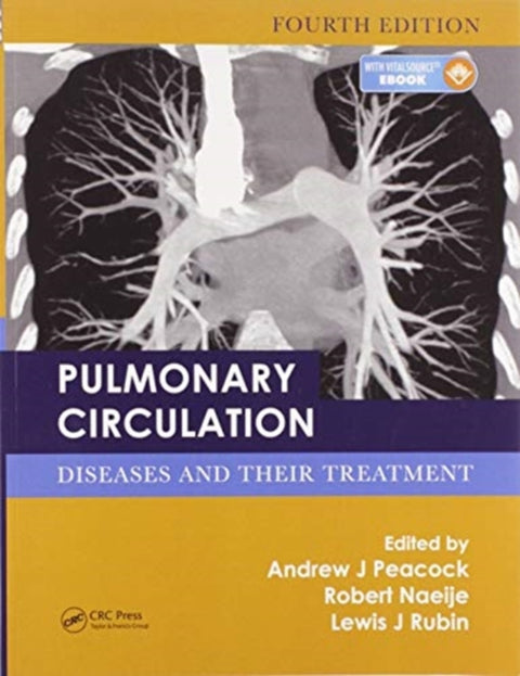 Pulmonary Circulation