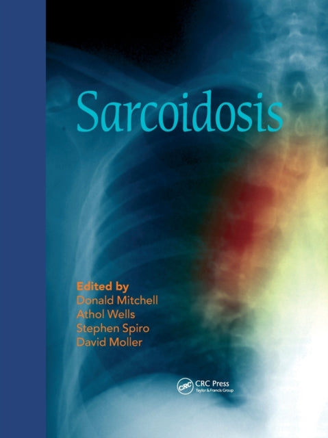 Sarcoidosis