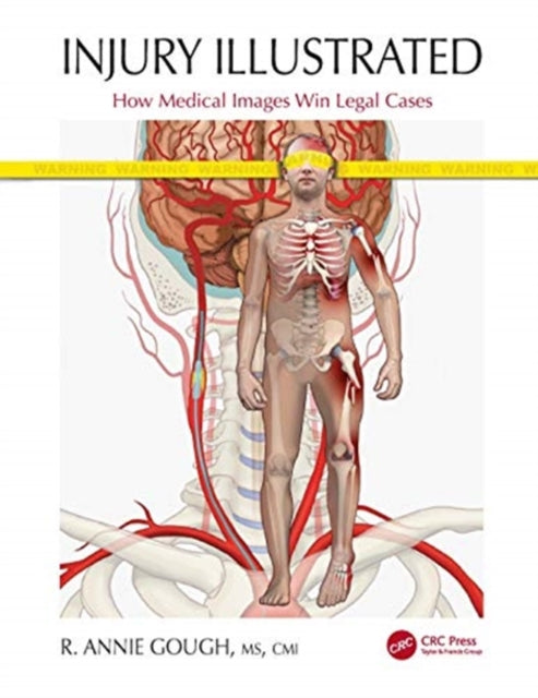 Book cover of: Injury Illustrated. By: R. Annie Gough