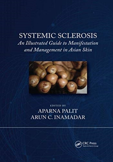 Book cover of: Systemic Sclerosis. By: Arun C. Inamadar