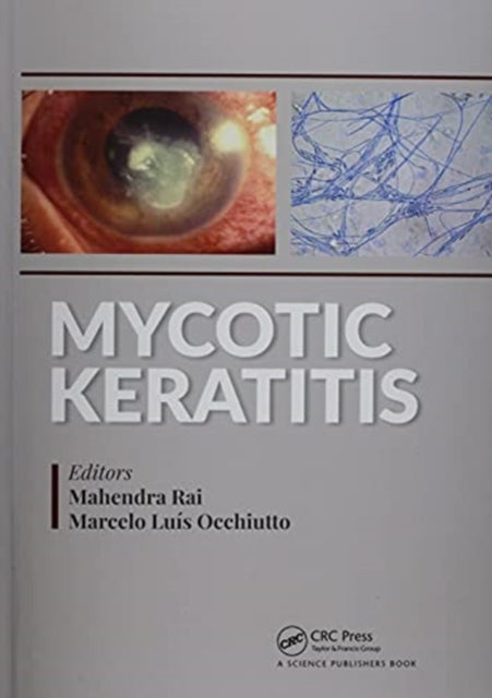 Book cover of: Mycotic Keratitis. By: Mahendra Rai
