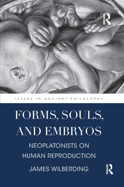 Book cover of: Forms, Souls, and Embryos. By: James Wilberding